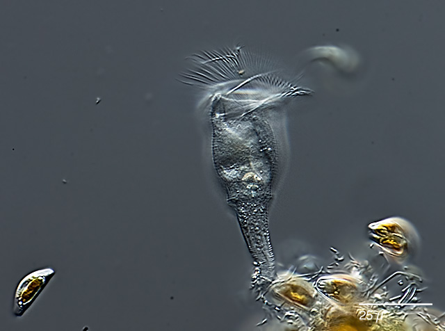 Leben im TeichScyphidia rugosa, Peritrichia, Wimpertiere (Ciliata)